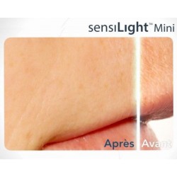 SENSILIGHT MINI 50 000 FLASHS