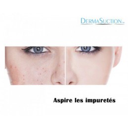 DERMA SUCTION X2